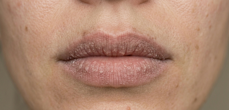 Rough Lips