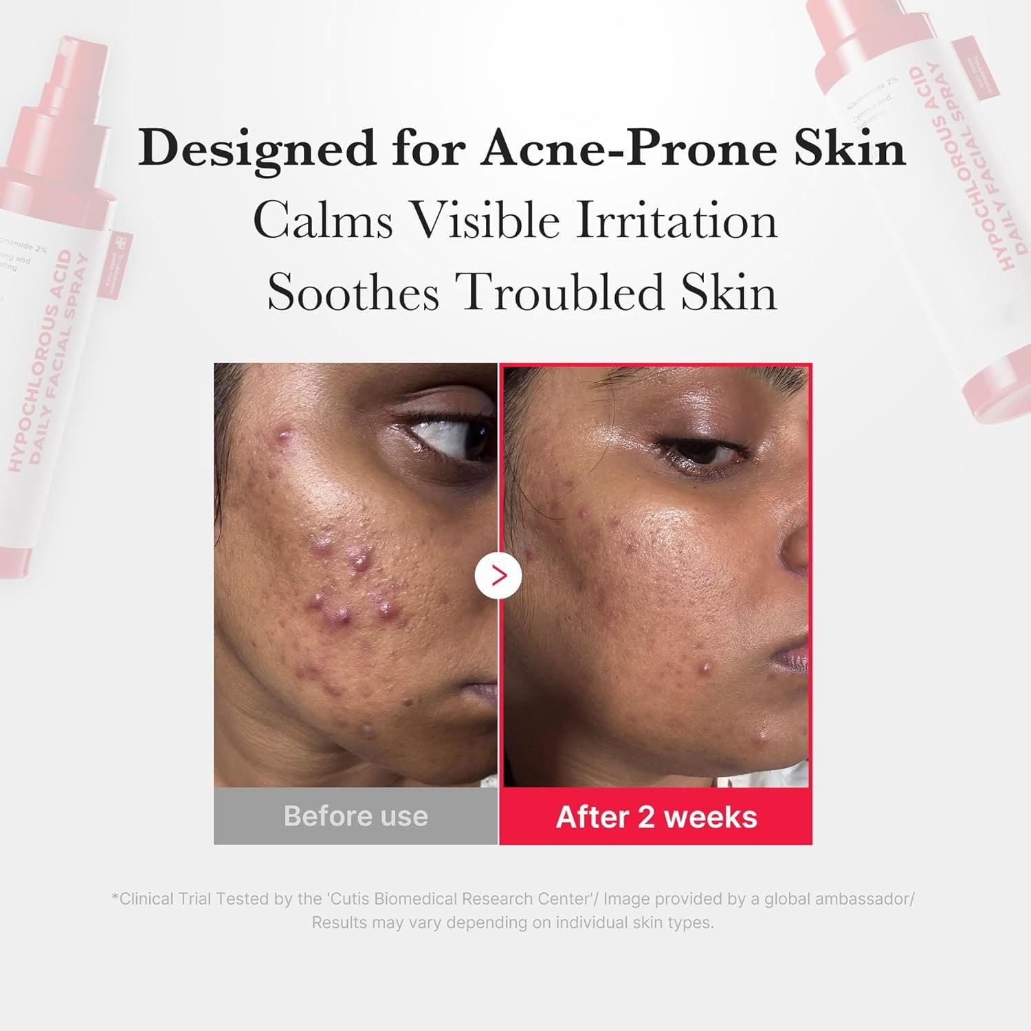 SKINNOVA™ DAILY BALANCE ACTIVE FACIAL SPRAY